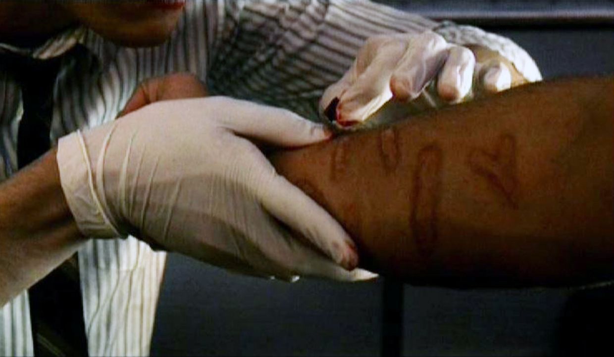 Dr. Bryar glaubt, dass ihm ein Chip-Implantat aus seinem Arm entfernt wird ... - Bildquelle: Touchstone Television